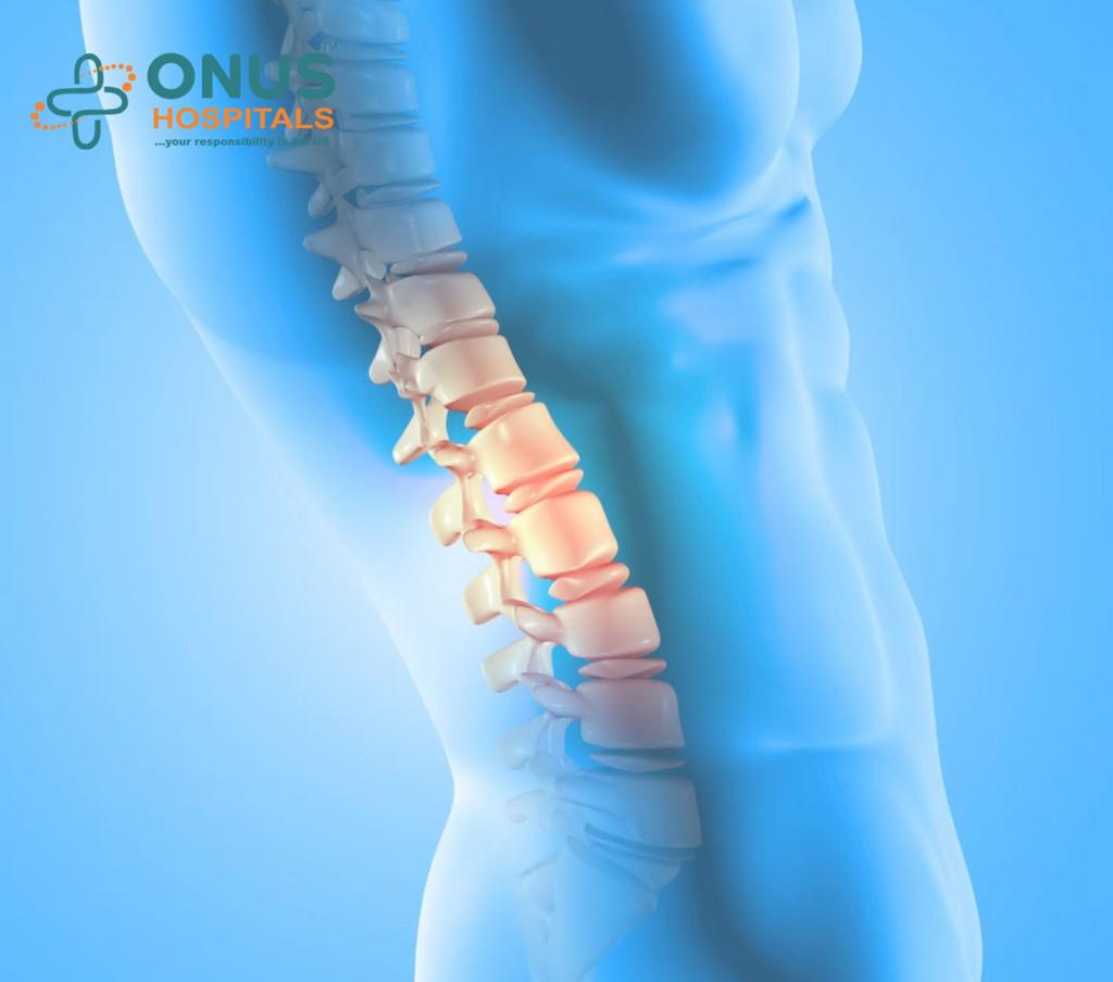  Spinal Fusion Surgery  : What You Should Know?